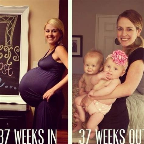 Pregnancy before and after : r/beforevsafter .